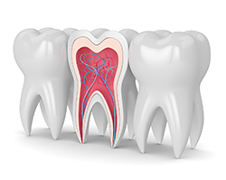 Professionelle Zahnreinigung | Zahnarzt